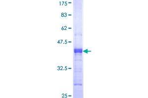 Image no. 1 for Myelin Associated Glycoprotein (MAG) (AA 119-208) protein (GST tag) (ABIN1310021)
