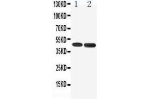 Anti-5HT1A Receptor antibody, Western blotting Lane 1: Rat Brain Tissue Lysate Lane 2: Human U87 Cell Lysate (Serotonin Receptor 1A 抗体  (C-Term))