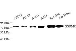 Western blot analysis of GSDMC (ABIN7074590) at dilution of 1: 50 (MLZE 抗体)