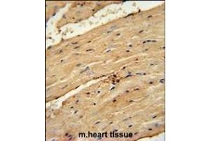 TI Antibody (Center) (ABIN654107 and ABIN2843990) immunohistochemistry analysis in formalin fixed and paraffin embedded mouse heart tissue followed by peroxidase conjugation of the secondary antibody and DAB staining. (TIMP4 抗体  (AA 48-74))