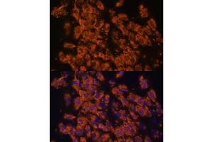 Immunofluorescence analysis of C6 cells using LRRC7 antibody (ABIN6128203, ABIN6143347, ABIN6143348 and ABIN6216986) at dilution of 1:100. (LRRC7 抗体  (AA 730-890))