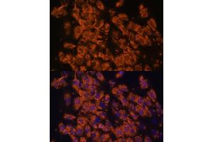 Immunofluorescence analysis of C6 cells using LRRC7 antibody (ABIN6128203, ABIN6143347, ABIN6143348 and ABIN6216986) at dilution of 1:100. (LRRC7 抗体  (AA 730-890))