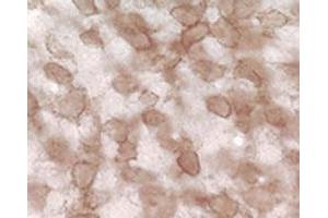 Immunohistochemical staining of pan synuclein in rat cochlear nucleus using Synuclein (pan) polyclonal antibody . (Synuclein 抗体)