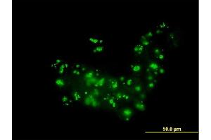 Immunofluorescence of monoclonal antibody to RAB36 on A-431 cell. (RAB36 抗体  (AA 234-333))