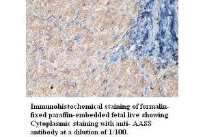 Image no. 1 for anti-Aminoadipate Semialdehyde Synthase (AASS) antibody (ABIN1574369) (AASS 抗体)