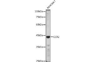 Western blot analysis of extracts of R. (CCR2 抗体  (AA 315-374))