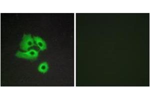 Immunofluorescence analysis of COS7 cells, using CCBP2 Antibody. (CCBP2 抗体  (AA 335-384))