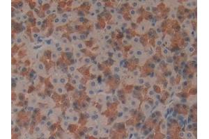 Detection of IFNg in Rat Stomach Tissue using Monoclonal Antibody to Interferon Gamma (IFNg) (Interferon gamma 抗体  (AA 23-156))