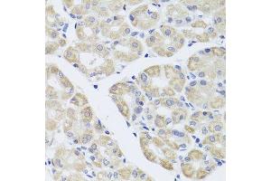 Immunohistochemistry of paraffin-embedded human stomach using DISC1 antibody. (DISC1 抗体  (AA 1-200))
