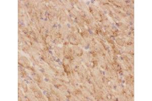 IHC-F testing of GLUT4 antibody and mouse heart tissue (GLUT4 抗体  (AA 333-509))