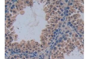 Detection of PFKP in Mouse Testis Tissue using Polyclonal Antibody to Phosphofructokinase, Platelet (PFKP) (PFKP 抗体  (AA 247-473))