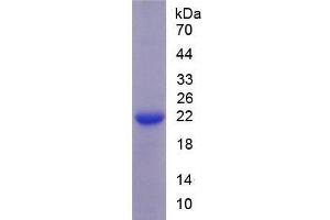 SDS-PAGE of Protein Standard from the Kit (Highly purified E. (SLC12A3 ELISA 试剂盒)
