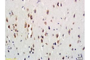 Formalin-fixed and paraffin embedded rat brain labeled with Anti-G-CSFR/CD114 Polyclonal Antibody, Unconjugated (ABIN742275) at 1:600 followed by conjugation to the secondary antibody and DAB staining (CSF3R 抗体  (AA 101-200))