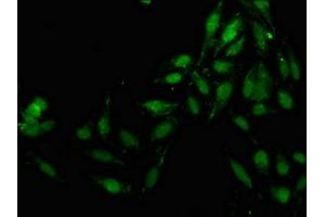 Immunofluorescence staining of Hela cells with ABIN7157162 at 1:133, counter-stained with DAPI. (JMY 抗体  (AA 708-848))