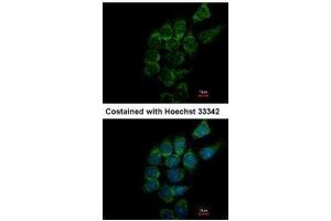 ICC/IF Image Immunofluorescence analysis of methanol-fixed Hep3B, using SIAT4A, antibody at 1:500 dilution. (ST3GAL1 抗体)