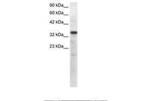 Image no. 1 for anti-T-Box 10 (TBX10) (AA 41-90) antibody (ABIN6735829)