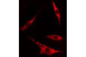 ABIN6274445 staining 293 cells by IF/ICC. (DOK4 抗体  (N-Term))