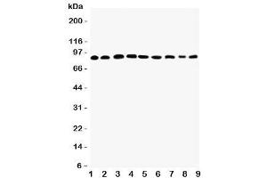 Western blot testing of Plakophilin 2 antibody and Lane 1:  rat heart (Plakophilin 2 抗体  (C-Term))