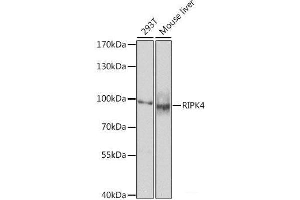 RIPK4 抗体