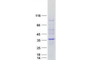 Validation with Western Blot