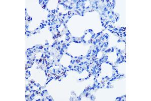Immunohistochemistry (IHC) image for anti-Cystathionine-beta-Synthase (CBS) antibody (ABIN7266615)