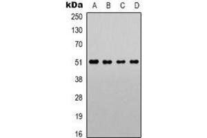 Western blot analysis of Alpha-1A Adrenergic Receptor expression in LOVO (A), Jurkat (B), NIH3T3 (C), PC12 (D) whole cell lysates. (alpha 1 Adrenergic Receptor 抗体  (C-Term))