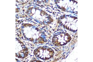 Immunohistochemistry (IHC) image for anti-Pyruvate Kinase M1/2 (PKM) (AA 11-221) antibody (ABIN6145714)