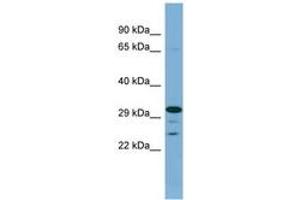 Image no. 1 for anti-Dehydrogenase/reductase (SDR Family) Member 9 (DHRS9) (AA 215-264) antibody (ABIN6741830) (DHRS9 抗体  (AA 215-264))