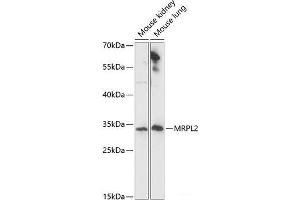 Western blot analysis of extracts of various cell lines using MRPL2 Polyclonal Antibody at dilution of 1:1000. (MRPL2 抗体)