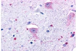 Anti-GPR37 antibody  ABIN1048809 IHC staining of human brain, neurons and glia. (GPR37 抗体  (N-Term))
