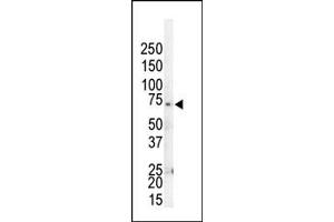 Western blot analysis of anti-GRK4 Pab (ABIN1882085 and ABIN2841170) in HL60 cell lysate. (GRK4 抗体  (C-Term))