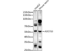 Western blot analysis of extracts of various cell lines, using  antibody (ABIN7265465) at 1:1000 dilution. (ADCY10 抗体)