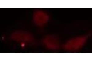 ABIN6275552 staining  Hela cells by IF/ICC. (PPP4R2 抗体  (Internal Region))