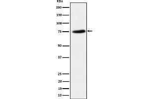 Western blot analysis of PPM1G expression in HeLa cell lysate. (Recombinant PPM1G 抗体)