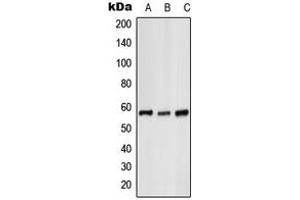 Western blot analysis of Glycerol Kinase 1 expression in HeLa (A), mouse liver (B), H9C2 (C) whole cell lysates. (Glycerol Kinase 1 抗体  (C-Term))