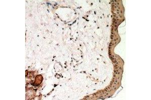 Immunohistochemical analysis of Desmoglein 1 staining in human skin formalin fixed paraffin embedded tissue section. (Desmoglein 1 抗体  (N-Term))