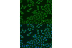 Immunofluorescence analysis of U2OS cells using PLA2G4C antibody (ABIN2737385) at dilution of 1:100. (PLA2G4C 抗体)