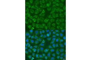 Immunofluorescence (IF) image for anti-Phosphatidylinositol-4-Phosphate 5-Kinase, Type I, beta (PIP5K1B) (AA 190-470) antibody (ABIN6145684)