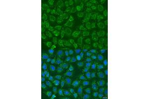 Immunofluorescence analysis of U2OS cells using PIP5K1B antibody (ABIN6130645, ABIN6145684, ABIN6145686 and ABIN6223693) at dilution of 1:100. (PIP5K1B 抗体  (AA 190-470))