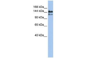 WB Suggested Anti-SUPT5H Antibody Titration:  0. (SUPT5H 抗体  (Middle Region))