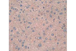 IHC-P analysis of liver tissue, with DAB staining. (CPN1 抗体  (AA 159-325))