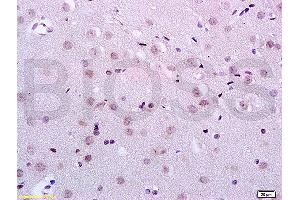 Formalin-fixed and paraffin embedded rat brain tissue labeled with Anti-KDM5B/PLU1/Jarid1B Polyclonal Antibody, Unconjugated (ABIN762986) at 1:200 followed by conjugation to the secondary antibody and DAB staining (KDM5B 抗体  (AA 65-165))