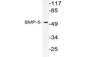 Western blot analysis of BMP-5 Antibody in extracts from HUVEC cells. (BMP5 抗体)