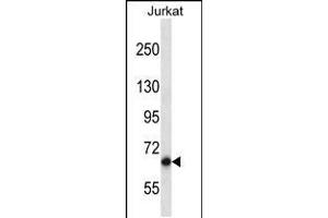Western blot analysis in Jurkat cell line lysates (35ug/lane). (PAN3 抗体  (C-Term))