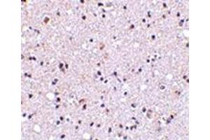 Immunohistochemistry of TMP21 in human brain tissue with this product at 5 μg/ml. (TMED10 抗体  (Center))
