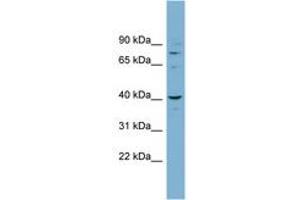 Image no. 1 for anti-Cancer Susceptibility Candidate 3 (CASC3) (N-Term) antibody (ABIN6742086) (CASC3 抗体  (N-Term))
