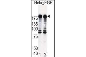 Western blot analysis of EGFR (arrow) in Hela cell lysates, either induced (Lane 1) or noninduced with EGF (Lane 2). (EGFR 抗体  (AA 1048-1077))