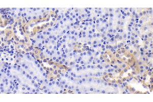 Detection of FN in Mouse Kidney Tissue using Polyclonal Antibody to Fibronectin (FN) (Fibronectin 抗体  (AA 2117-2236))