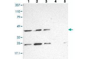 Western blot analysis of Lane 1: RT-4, Lane 2: EFO-21, Lane 3: A-431, Lane 4: Liver, Lane 5: Tonsil with DRG1 polyclonal antibody . (DRG1 抗体)