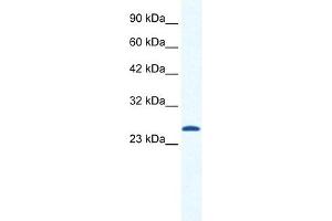 CACNG6 antibody used at 1. (CACNG6 抗体  (N-Term))